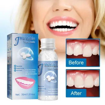 Shop Moldable.false Teeth with great discounts and prices online - Oct 2023